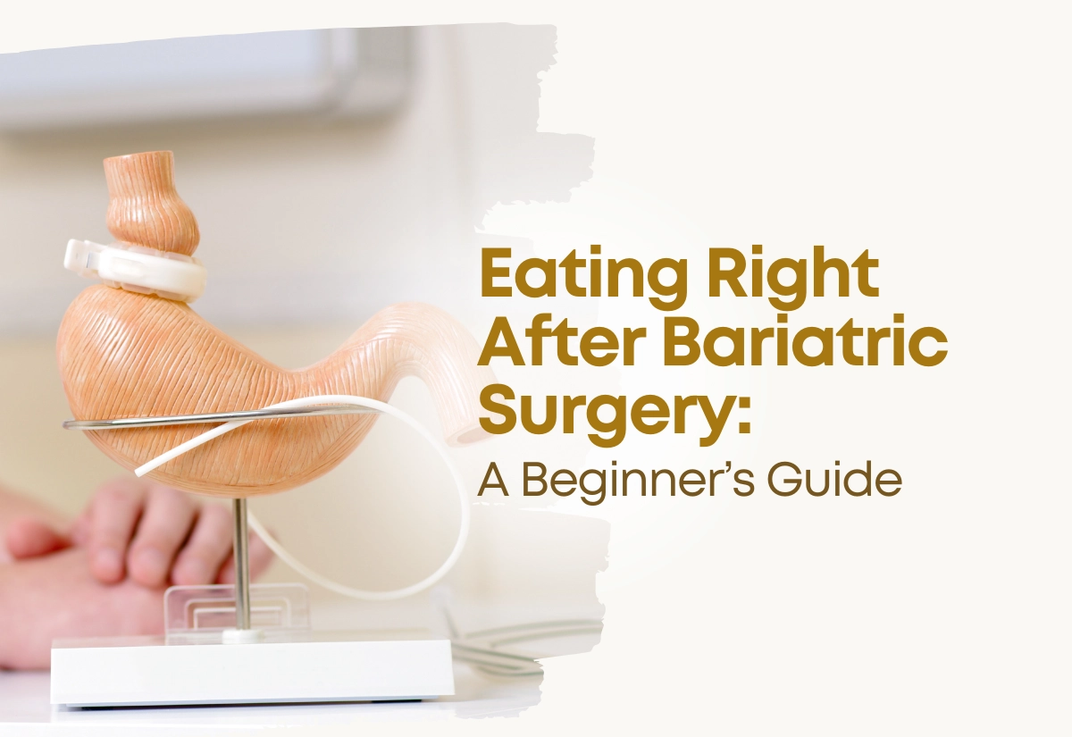 Eating Right After Bariatric Surgery: A Beginner’s Guide